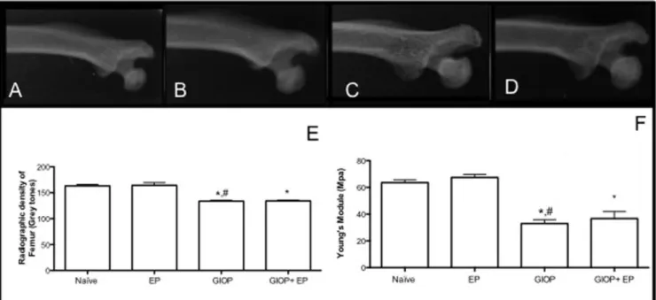 Figure  5.  Effect  of  GIOP  on  femur  of  rats  with  experimental  periodontitis. 