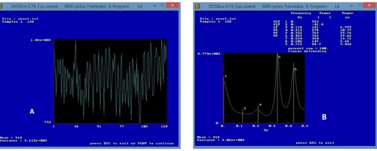 Figura 4. Programa utilizado para análise espectral (desenvolvido pelo Prof. Dr. Alberto Porta da Università degli Studi di  Milano, Milão, Itália): (A): tacograma com os iRR (N=256); (B) decomposição do sinal dos iRR em bandas de frequência