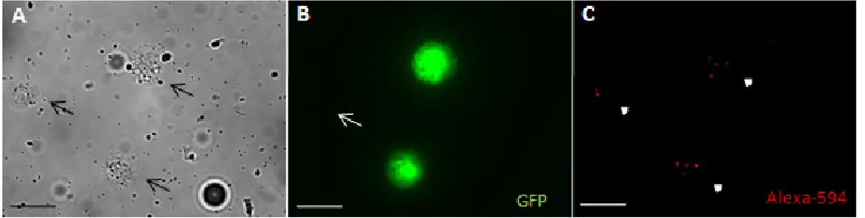 Figure  7  -  Phagocytosis of fluorescence E.coli  by w;HeGAL4;UASGFP line  plasmatocytes:  (A) three plasmatocytes were analyzed in this Bright Field area (black  arrows)