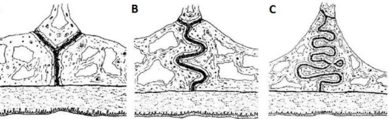 Figure 2.6: Illustration of different stage of the maturation process of the median palatine suture