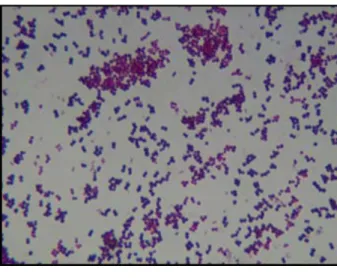 Figura 2 - Morfologia do Staphylococcus aureus corada pelo método de Gram apresentando  formato de cacho de uva