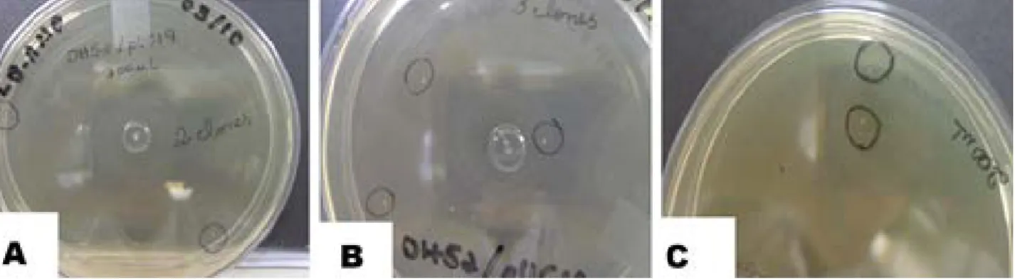 Figura 7 – Crescimento de E.coli transformada em meio LB com antibiótico ampicilina. A) Crescimento de 2 colônias na  concentração de 50 µl de cultura com células transformadas; B) Crescimento de 3 colônias na concentração de 100 µl de  cultura com células