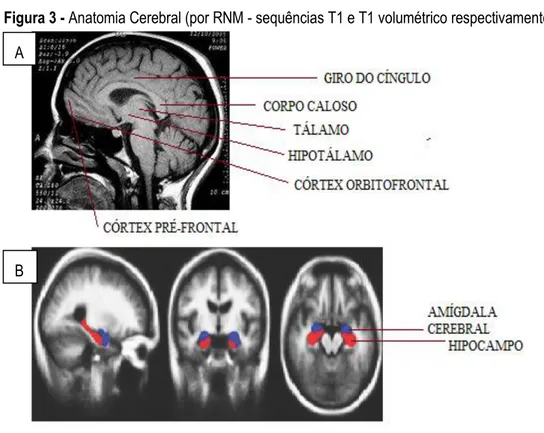 Figura 3 - Anatomia Cerebral (por RNM - sequências T1 e T1 volumétrico respectivamente)