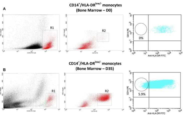 Fig. 1   Flow cytometric analysis in BM of patient number 1 at D0 and  D35, respectively