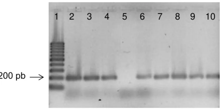 Figura 16 - Eletroforese em gel de agarose (2%) da PCR de colônia.  