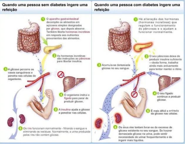 Figura 2 – Comparação entre a decomposição dos alimentos numa pessoa sem e com diabetes, adaptado  de [11]