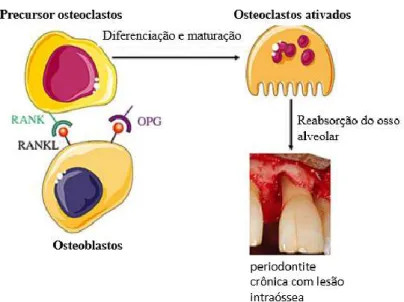 Figura 9. Papel do sistema RANKL/RANK/OPG na doença periodontal, adaptado de (Dagorne &amp; Rangé,  2014) 