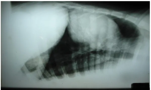 Figura 5 - Radiografia torácica decúbito lateral esquerdo com aspectos normais, sem sinais de metástases