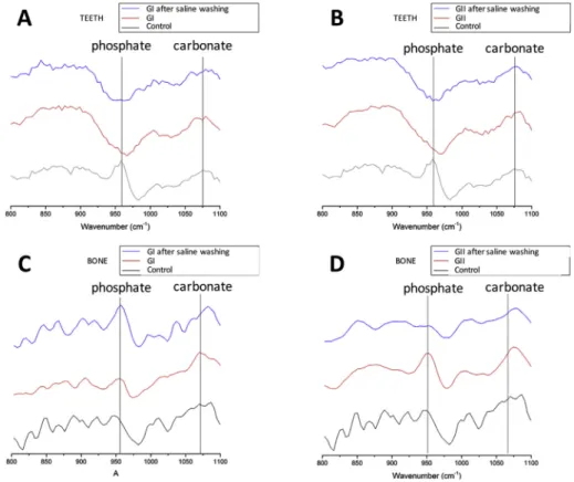 Fig. 3. Raman spectra of the phosphate (960 cm 1 ) and carbonate (1070 cm 1 ) bands. (A) Teeth specimens subjected to Carnoy's solution with chloroform