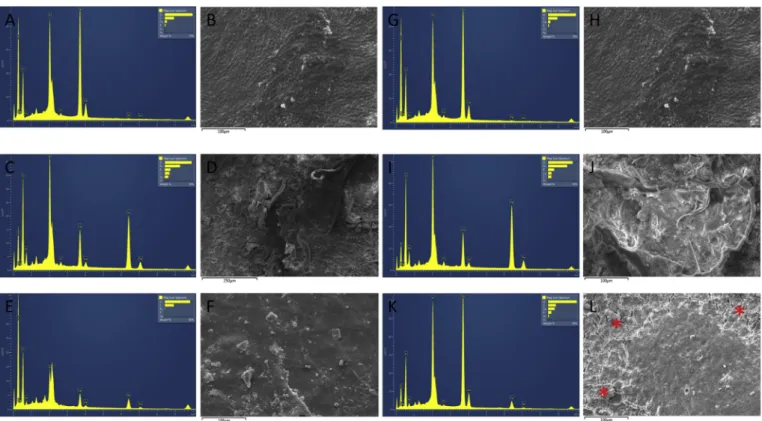 Fig. 7. Scanning electron microscopy and energy-dispersive spectroscopy analysis on teeth specimens
