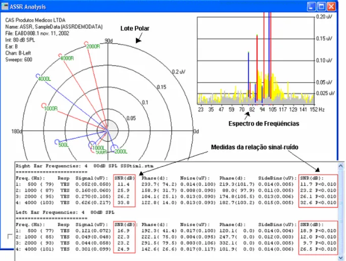 FIGURA 8 - Duas medidas da relação sinal-ruído realizadas pelo sistema SmartEP ASSR  Fonte: INTELIGENTE HEARING SYSTEMS, 2008