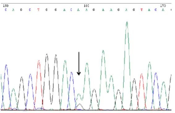 Figura 3.7. Eletroferograma parcial do exão 3 do gene NRAS. Mutação missense somática no codão 61: 