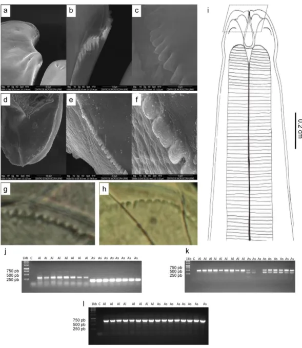 Figura 5: Diferenças morfológicas e moleculares entre A. lumbricoides e A. suum, (a, b, c): Morfologia  dos dentículos de A