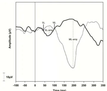 Figure 2. Example of a normal tracing obtained by G-VEMP. The recordings were made with  uninfected individual with head rotated to the left and EMG captured in right gastrocnemius  muscle