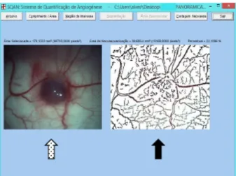 Figure 4 -   Interface  of  the  SQAN  system.  White  arrow =  panoramic  stereocopic  microphotograph  of  implant;  black arrow =skeletonized  area  of  neovascularization.