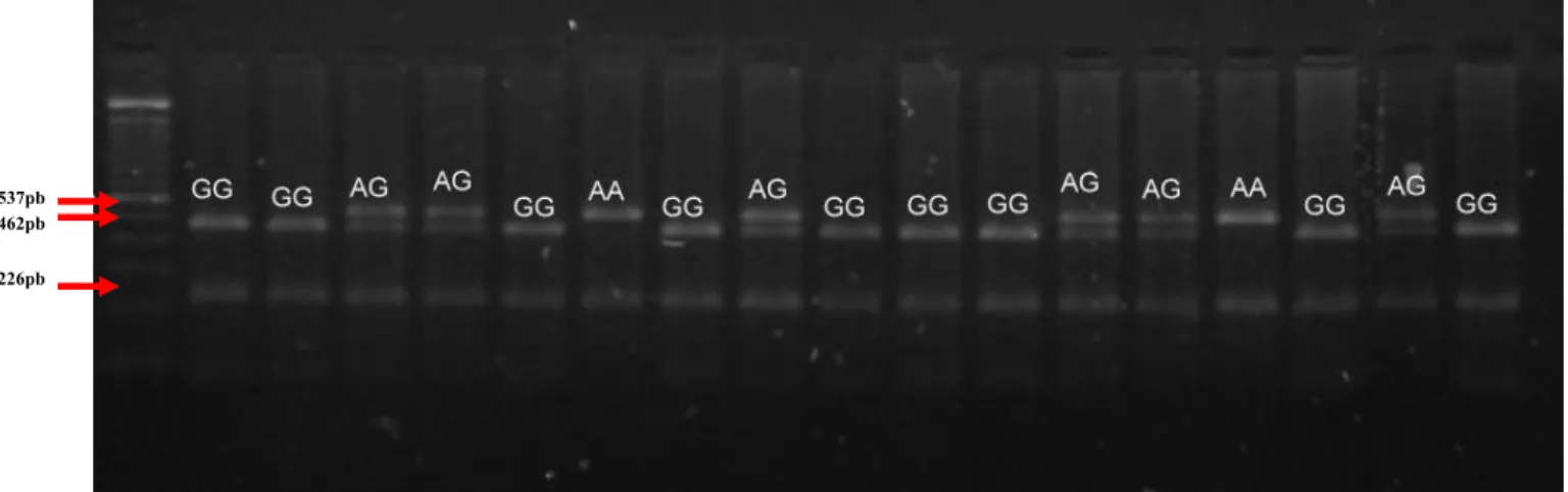 Figura 5: Imagem do gel de Agarose 3% mostrando o padrão de restrição para o SNP (BTA4), os animais com  alelo A apresentam os fragmentos de tamanhos de 537 e 226 pares de base (pb) e animais com o alelo G  apresentam os fragmentos de tamanhos de 462, e 22