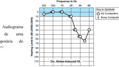 Figura  6.  Audiograma  representativo  de  uma  mudança  temporária  do  limiar auditivo