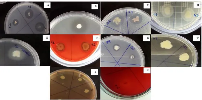 Figura 5 - Resultados positivos dos testes enzimáticos representados pela formação de halos  ao redor das colônias bacterianas