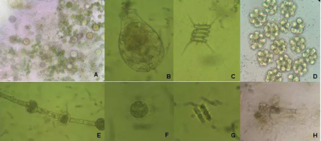 Figura  12  -  Imagens  de  microscopia  optica  do  perifíton  espontâneo  e  alguns  componentes do plâncton