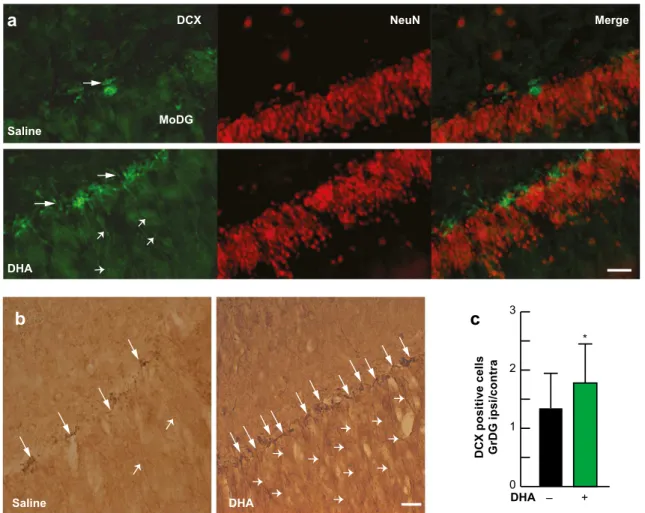 Fig. 5 DHA enhances neurogenesis after stroke. a Deconvolution microscopy images double-labeled with DCX (green) and NeuN (red) from saline- and DHA-treated rats 4 weeks after MCAo