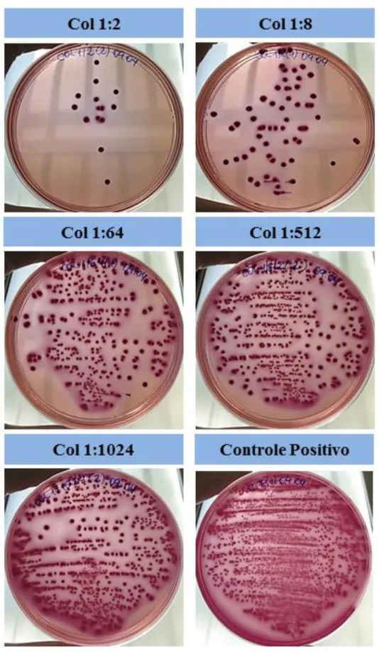 Figura  2  –  Fotos  representativas  dos  ensaios  de  viabilidade  do  biofilme  por  contagem  de  colônias  em  Ágar  Mac  Conckey
