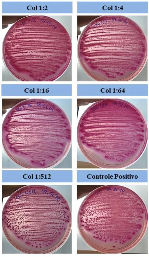 Figura  6  –  Fotos  representativas  dos  ensaios  de  viabilidade  do  biofilme  por  contagem  de  colônias em Ágar Mac Conckey