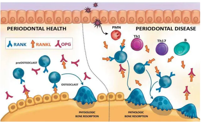 Figura 2. Osteoimunologia da doença periodontal.  