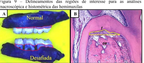 Figura  9  –  Delineamentos  das  regiões  de  interesse  para  as  análises  macroscópica e histométrica das hemimaxilas 