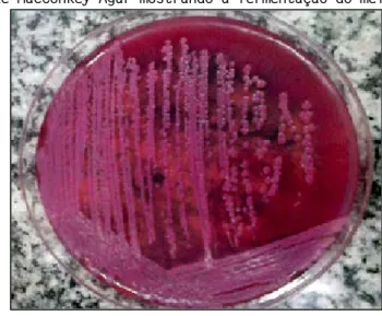 Figura 5: Placa de MacConkey Ágar mostrando a fermentação do meio pelas bactérias. 