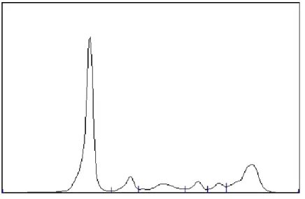 Figura 2 - Eletroforese das proteínas séricas 