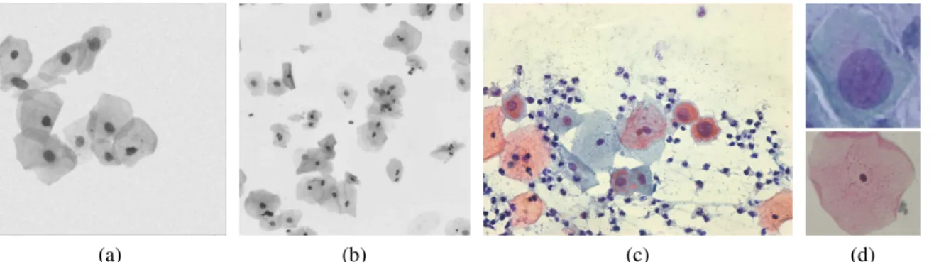 Figura 1 – Tipos de imagens de células cervicais. (a) Imagem sintética. (b) Meio líquido