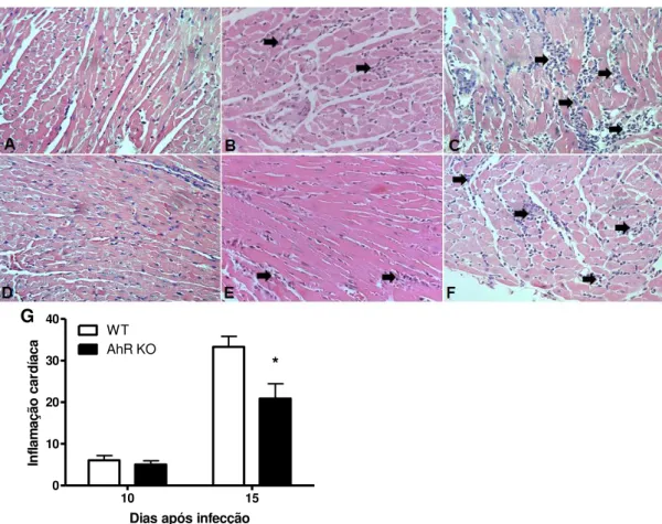 Figura  6.  Ausência  de  AhR  resulta  em  redução  de  células  inflamatórias  no  coração  de  camundongos infectados por T