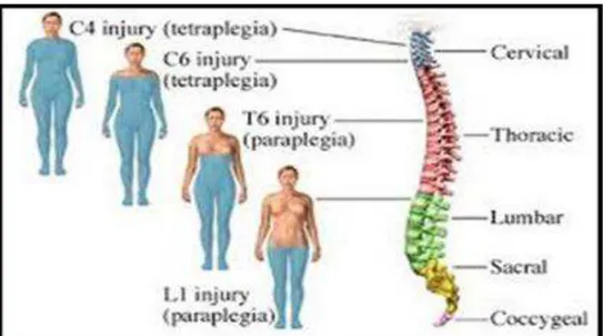 Figura  1.  Classificação  das  LM  de  acordo  com  o  nível  anatômico  da  lesão.  Fonte  –  Adaptado  de  Saint Lukes Health, 2009
