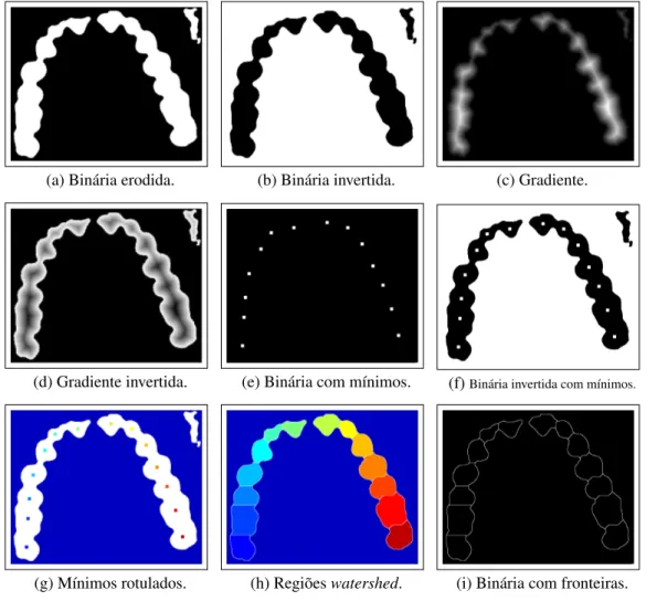 Figura 4.4: Processo de detecção de fronteiras dos dentes a partir de imagens gradientes.