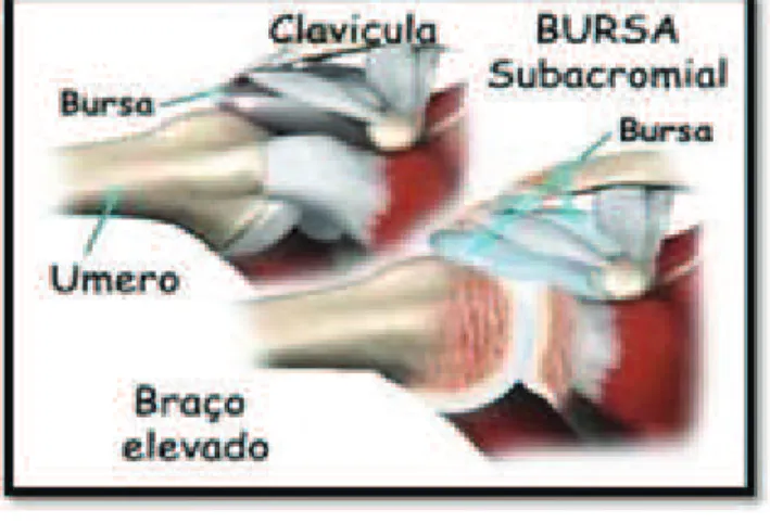 Figura 7 - Tipos morfológicos de acrômio descritos por Bigliani et al (1991). 