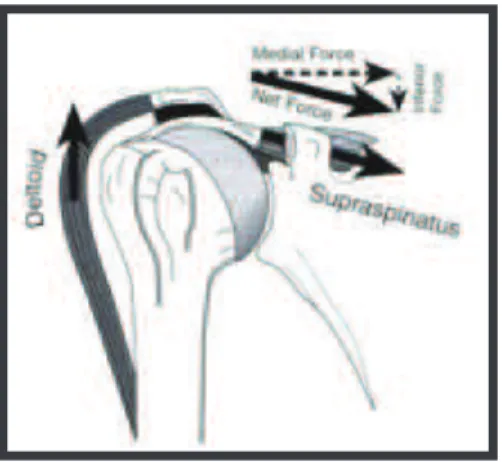 Figura 5 - Resultante de forças em desequilíbrio, permitindo a migração da cabeça umeral  em sentido proximal