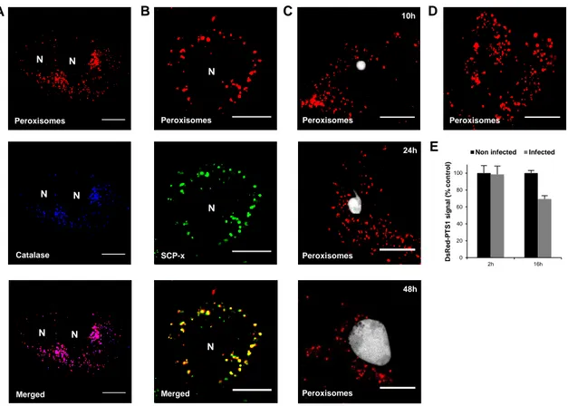 Figure 6. Host peroxisomal population may be altered in Plasmodium infected cells. (A) DsRed- DsRed-PTS1-transfected  cells  were  fixed  and  immunolabeled  for  catalase