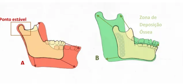 Figura  15-Diferentes  modos de avaliar o crescimento ósseo: a ilustração A  mostra o crescimento aparente,  modo  incorreto  de  avaliar  o  crescimento  e  desenvolvimento  de  um  osso