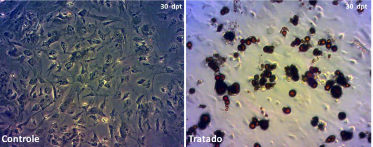 Figura 6: Formação de adipócitos nas mCTM 30 dias após o tratamento com indutores de  diferenciação adipogênica
