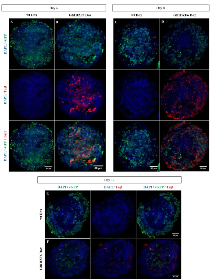 Figure  3.17  -  Induction  of  Tuj1  expression  in  Gfi1DZF6-PA:  Representative  images  obtained  from  ICC  for  Tuj1 (red) from  EBs  treated  for  2  (A,  B),  4  (C,  D)  and  8  (E,  F)  days  after  Dox  exposure  in  (A,  C,  E)  wt  Dox  and  (