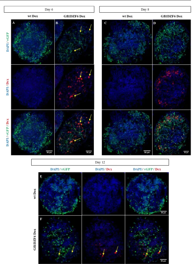 Figure 3.18 - Induction of Dcx expression in Gfi1DZF6-PA: Representative images obtained from ICC for Dcx (red) from EBs  treated  for  2  (A,  B),  4  (C,  D)  and  8  (E,  F)  days  after  Dox  exposure  in  (A,  C,  E)  wt  Dox  and  (B,  D,  F)  Gfi1DZ