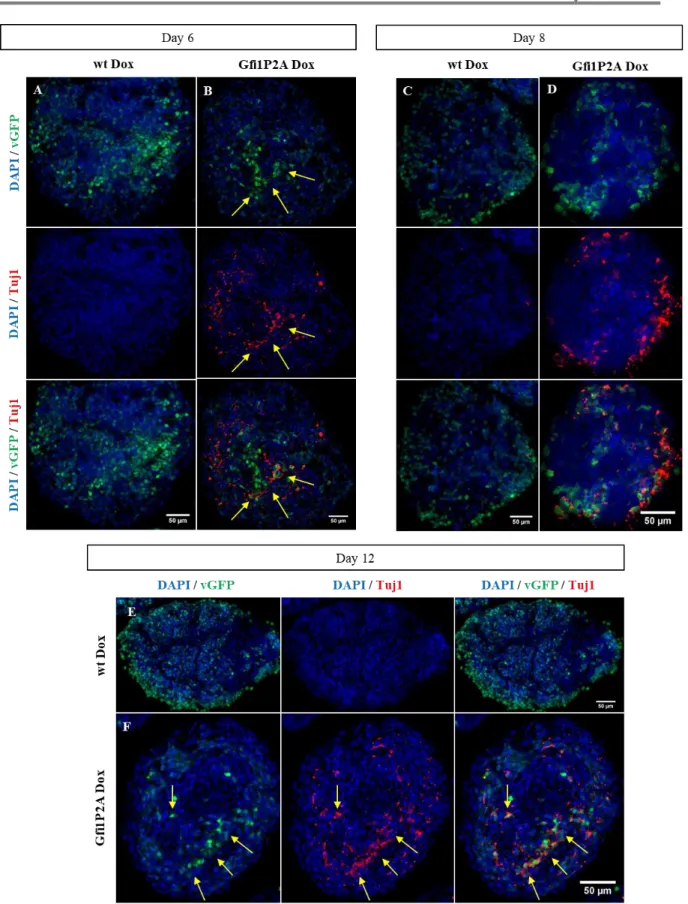 Figure 3.24 - Induction of Tuj1 expression in Gfi1P2A-PA: Representative images obtained from ICC for Tuj1 (red) from EBs  treated  for  2  (A,  B),  4  (C,  D)  and  8  (E,  F)  days  after  Dox  exposure  in  (A,  C,  E)  wt  Dox  and  (B,  D,  F)  Gfi1P