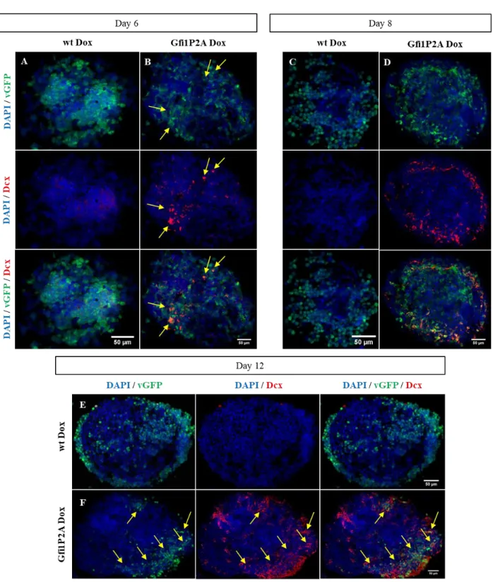 Figure 3.26 - Induction of Dcx expression in Gfi1P2A-PA: Representative images obtained from ICC for Dcx (red) from EBs  treated  for  2  (A,  B),  4  (C,  D)  and  8  (E,  F)  days  after  Dox  exposure  in  (A,  C,  E)  wt  Dox  and  (B,  D,  F)  Gfi1P2A