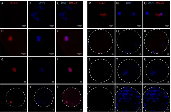Figure 15 ‐ ‘TACC3’ expression pattern during oocyte development and early embryogenesis. The oocyte progresses through meiosis displaying a (A‐C) germinal vesicle stage, a (D‐F, G‐I) metaphase I, 12H after maturation and a (J‐L) metaphase II stage, 23H af