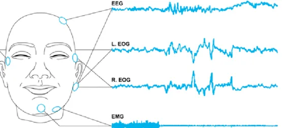 Figure 1.3.1 – Example of electroencephalogram (EEG), electrooculargram (EOG) and  electromyogram (EMG) (LaBerge, 2008)
