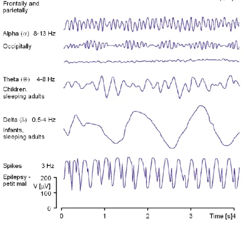 Figure 1.3.2.1 - Example of the waveforms for the different bands (Malmivuo and Plonsey,  1995)
