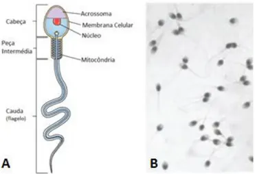 Figura 13 - A – Estrutura normal de um espermatozoide. (6)  B – Espermatozoides corados com  coloração de papanicolau