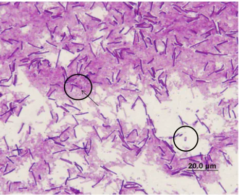 Figura  1  -  Coloração  de  Gram  da  cepa  ATCC  700057  de  Clostridioides  difficile  para  a  visualização dos esporos subterminais (Aumento 1000x)