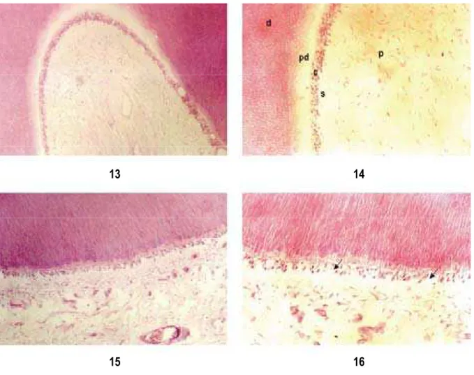 Fig. 16 Polpa normal do grupo 1. Nota-se áreas com desorganização da camada  odontoblástica