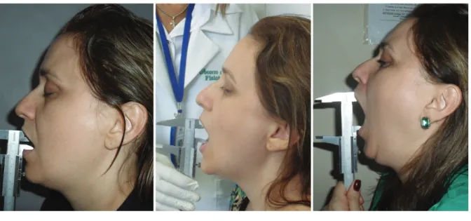 Figure 2. Evolution of the range of motion for mandibular lowering during the study.
